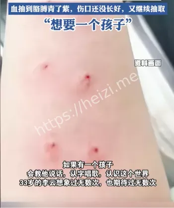 李云