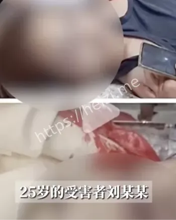 长期家暴