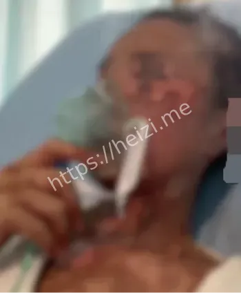 高颜值女子毁容