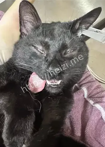 吸猫致哮喘急性发作