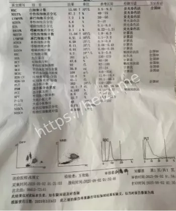 水质污染