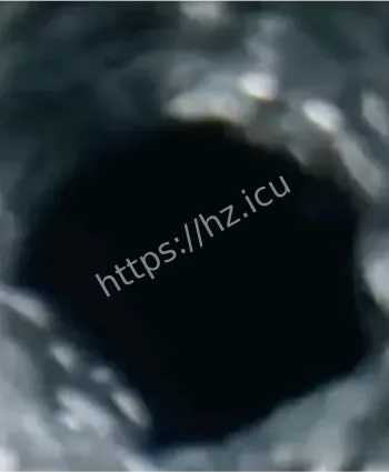 4名工人窒息悲剧