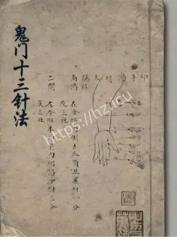 传统针灸安神镇静神经