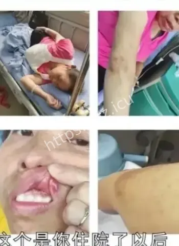 起诉离婚千万被转走